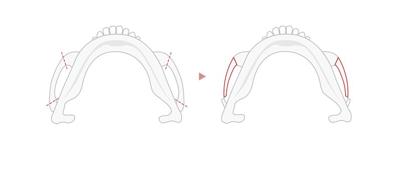 Type of procedure done at our clinic image