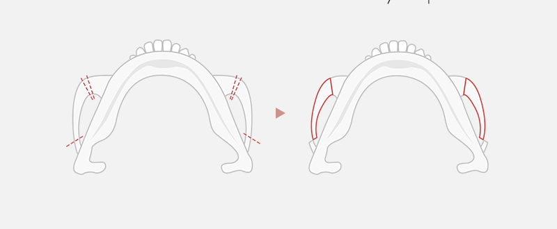 Type of procedure done at our clinic second image