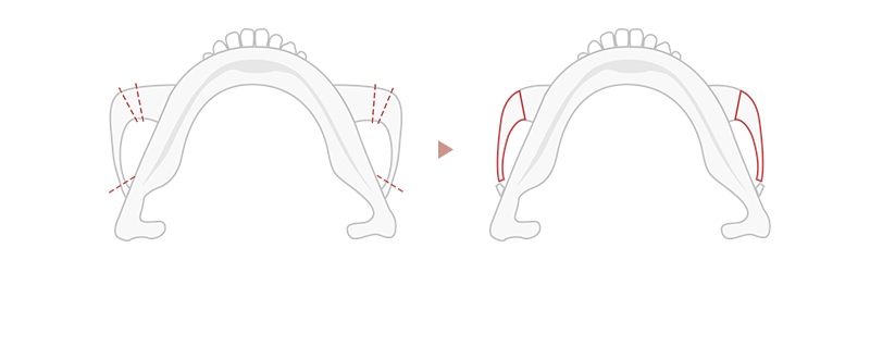 Type of procedure done at our clinic third image