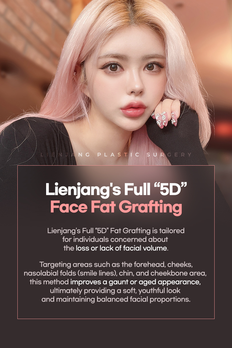 Full Face Fat Grafting