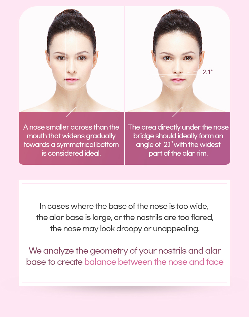 Ideal nose shape for Lienjang Alar reduction, nostril reduction, or Alarplasty in Korea