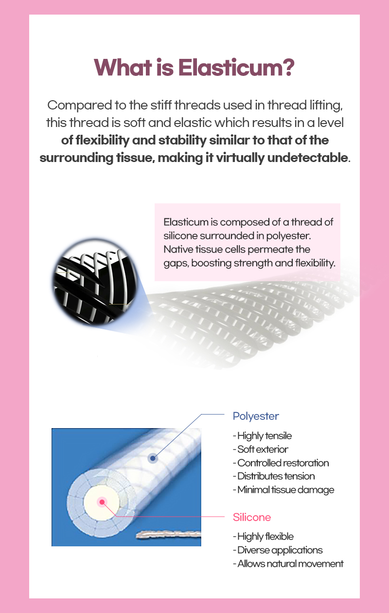 Elasticum threads for Lienjang Alar reduction, nostril reduction, or Alarplasty in Korea